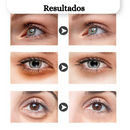 Pomada Anti Rugas Olheiras Bolsas JoyPretty |COMPRE 1 LEVE 2| + Frete Grátis